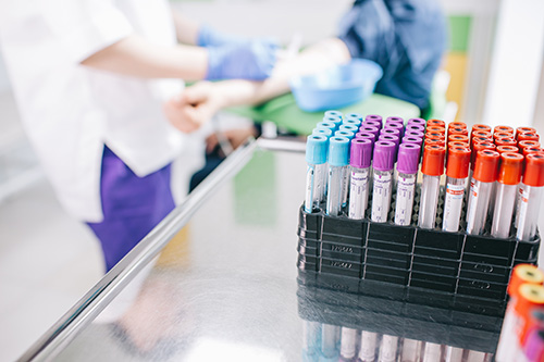 Аналізи (лабораторна діагностика)