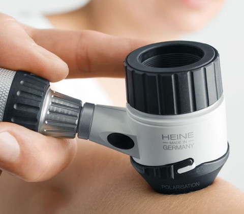 Дерматоскопія