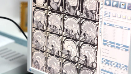 МРТ відкритого типу