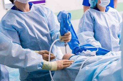 Відтепер в АЦМД ми лікуємо захворювання і травми суглобів методом артроскопії